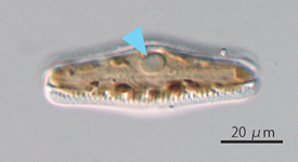 図1．ロパロディア科珪藻Rhopalodia gibba